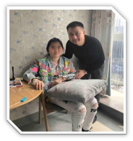 SLE系统性红斑狼疮