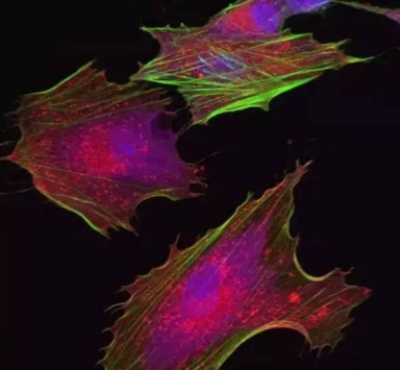 异体胚胎间充质干细胞（1亿细胞量）