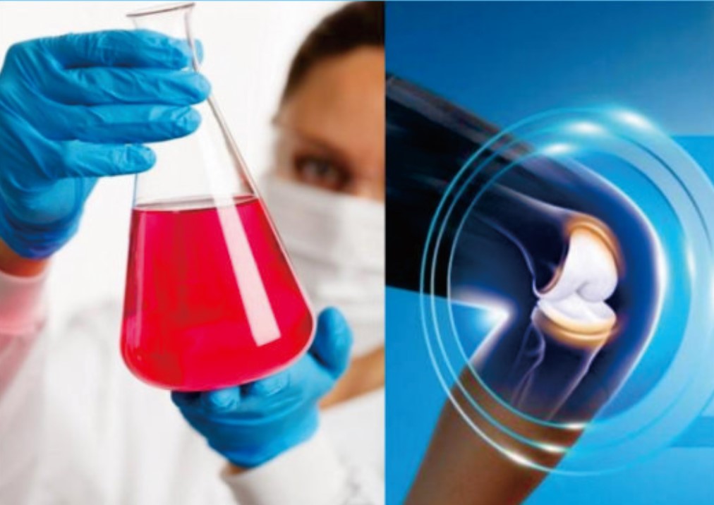 膝关节修复方案